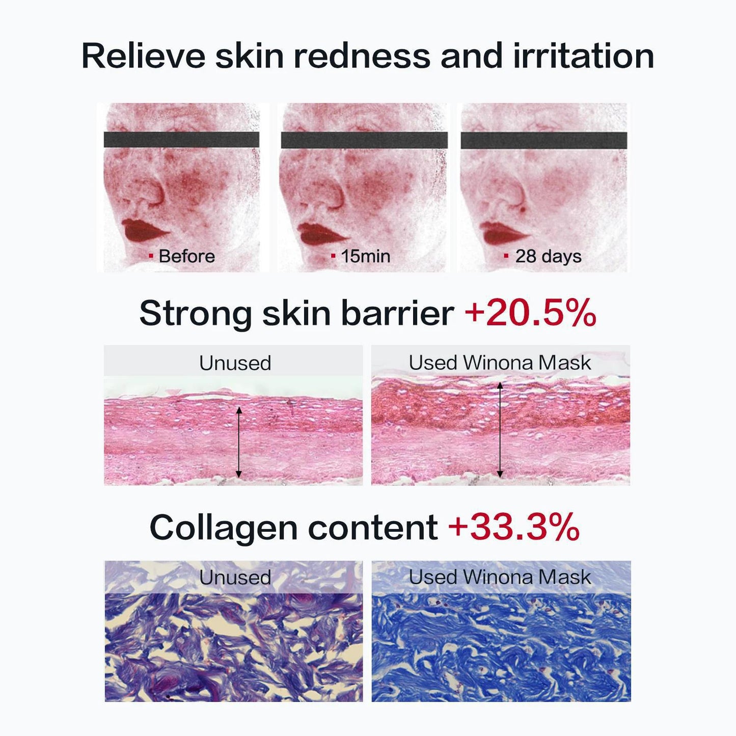 Winona Soothing Repairing Freeze-Dried Mask 薇诺娜舒缓修护冻干面膜组合(舒缓修护冻干面膜+溶媒液) 6pcs
