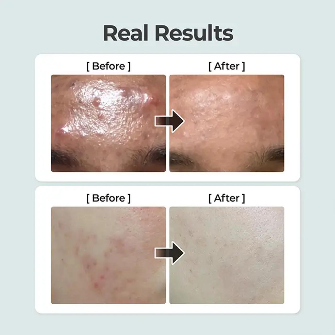 Numbuzin No.1 Pure-full Calming Herb Toner 数字1号滋润保湿爽肤水 300mL