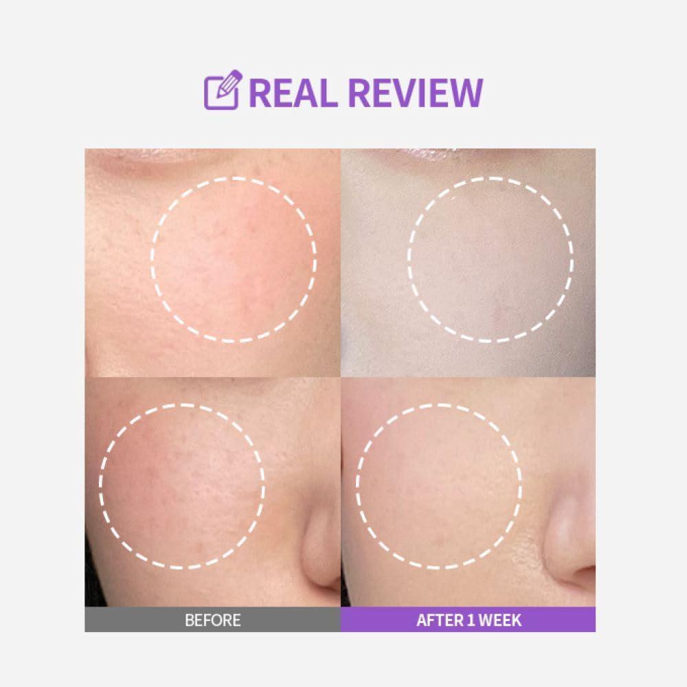Sungboon Editor Meoru Podo Vita C Dark Spot Ampoule 韩国Sungboon Editor祛斑维生素C面部精华液 30mL