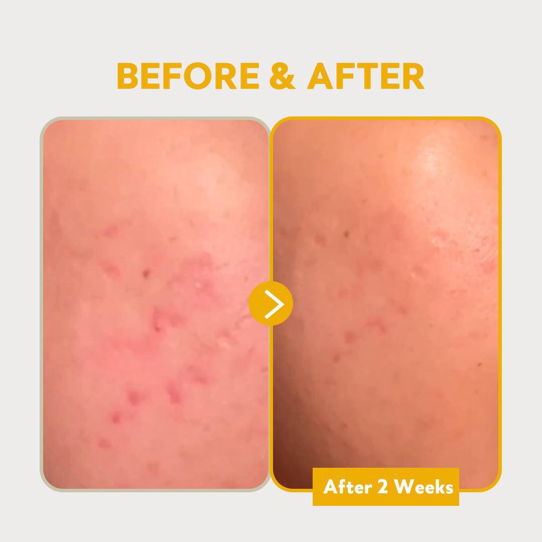 TIRTIR Pure Vitamin C 24% Serum 媞乐媞乐24%维生素C精华液 30mL