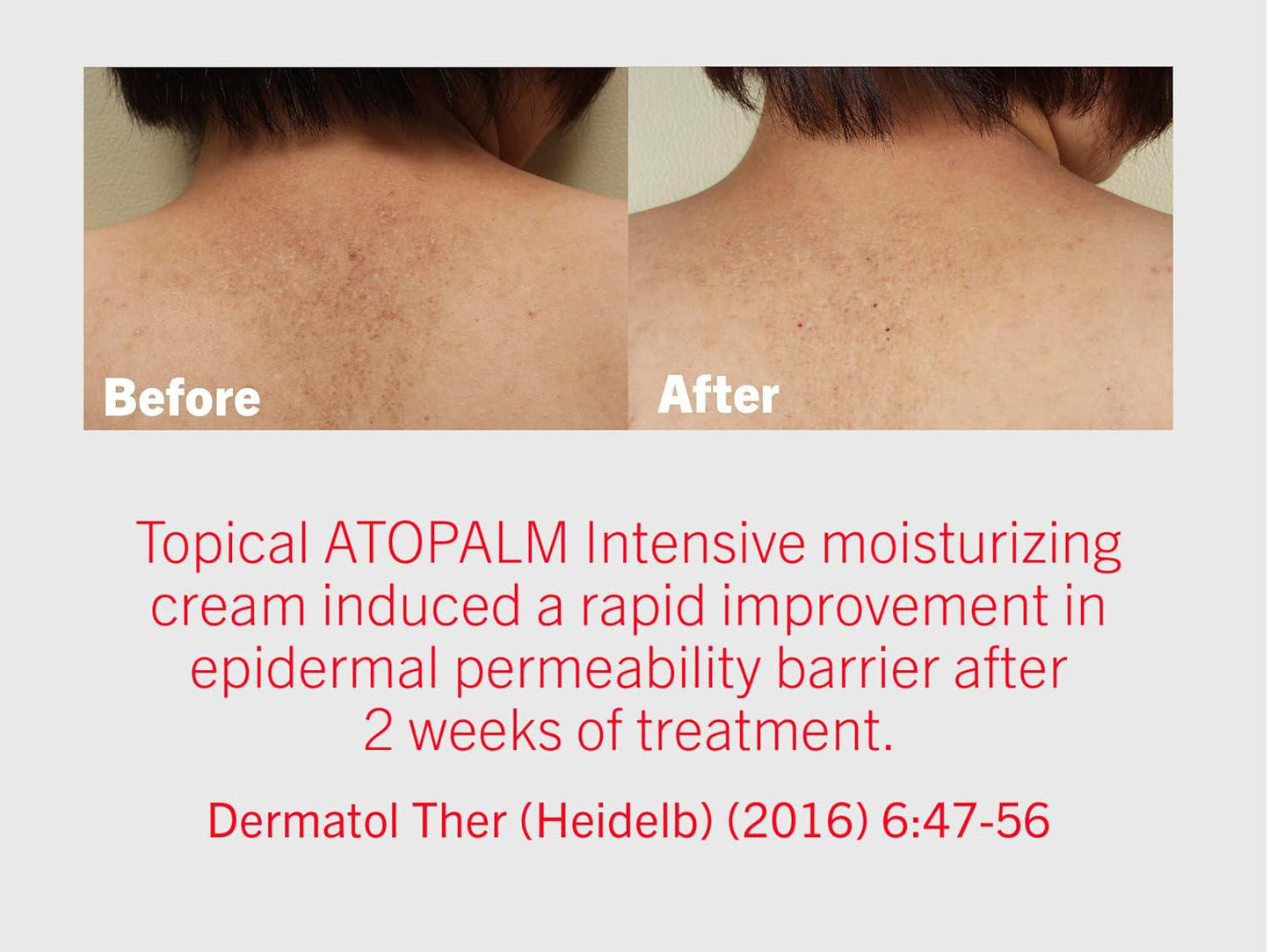ATOPALM Mle Cream 100ml 爱多康润肤修护保湿霜 100mL