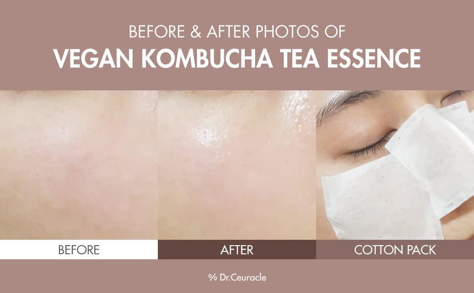 Dr.Ceuracle Vegan Kombucha Tea Tree Essence 舒罗蔻纯素康普茶精华液 150mL