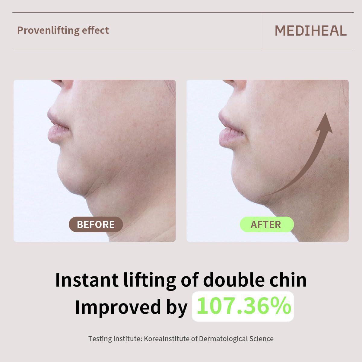 Mediheal Retinol Collagen Lifting Mask 美迪惠尔视黄醇胶原蛋白轮廓提拉弹力面膜 4pcs