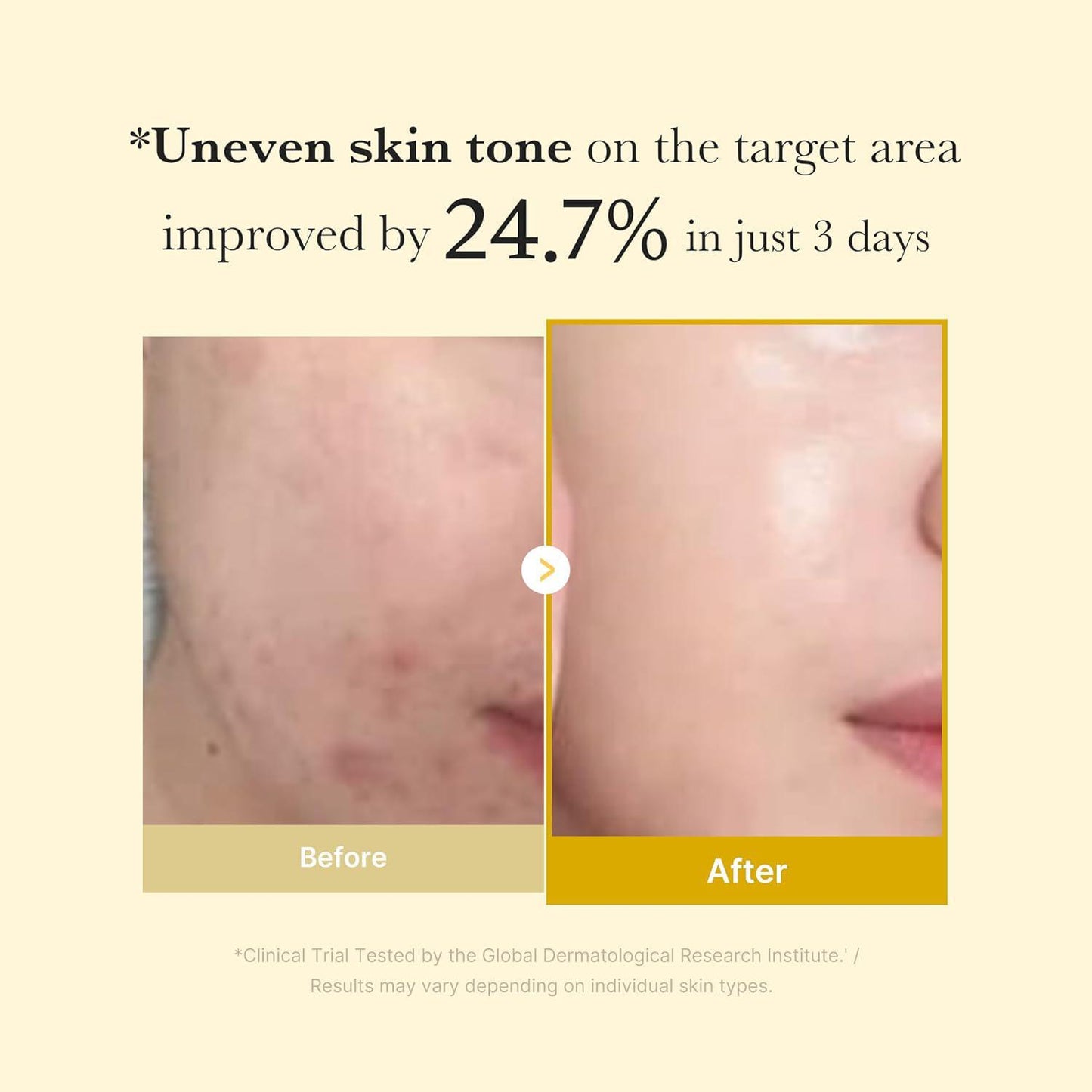 Medicube Kojic Acid Turmeric Night Wrapping Mask 美蒂秋芙曲酸姜黄夜间面膜 75mL