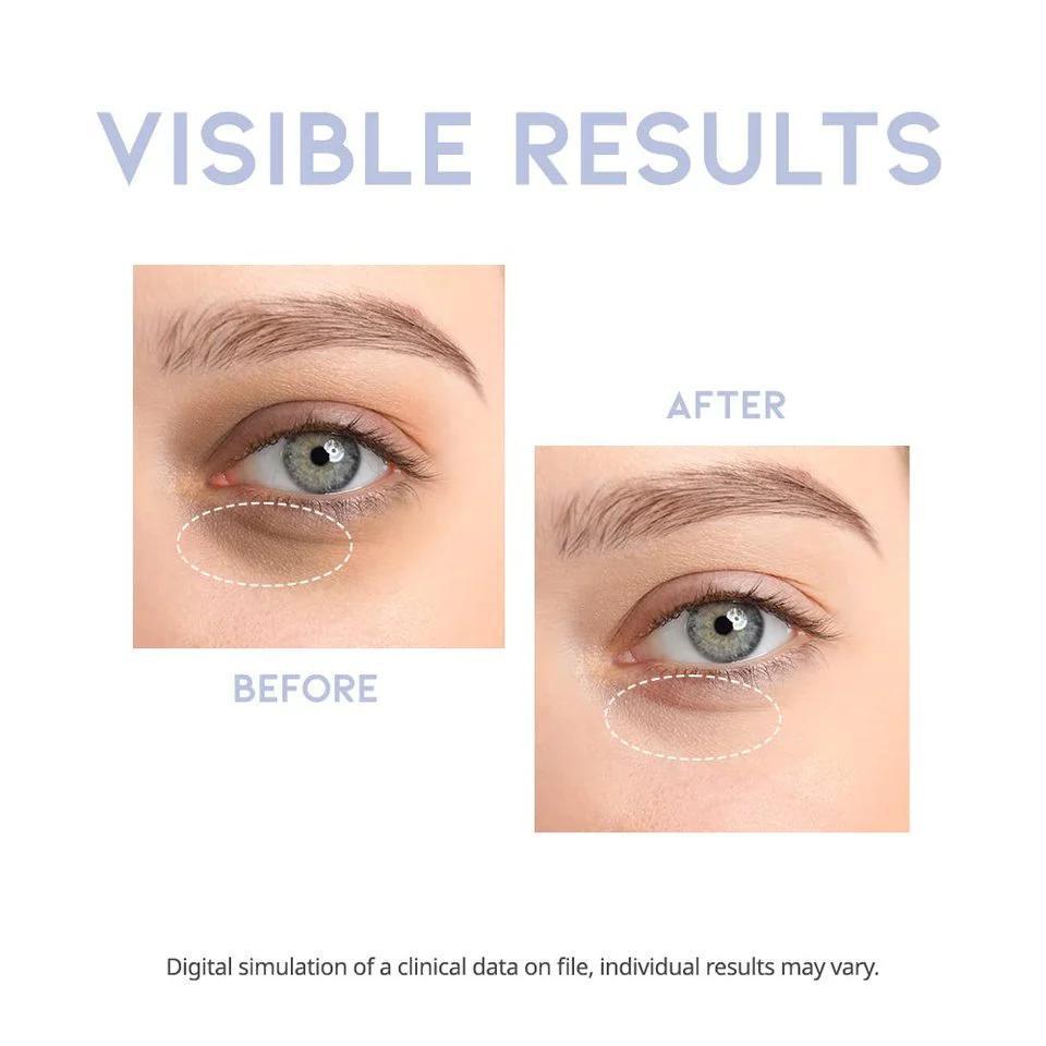 OOTD Beauty Intensive Eye Serum 韩国OOTD Beauty强效眼部精华液 30g