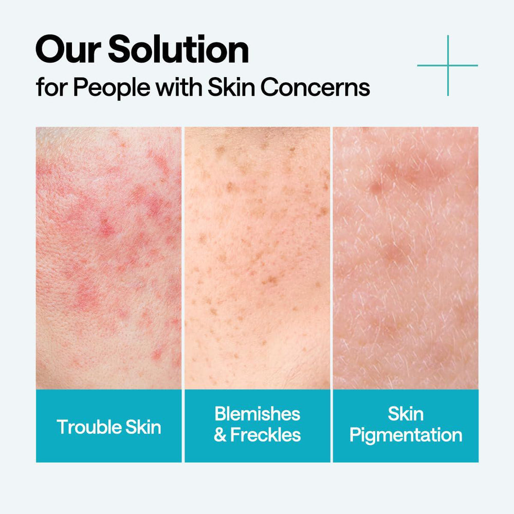 
                      
                        Mediheal Madecassoside Blemish Repair Serum 美迪惠尔积雪草苷淡斑修复精华 40mL
                      
                    