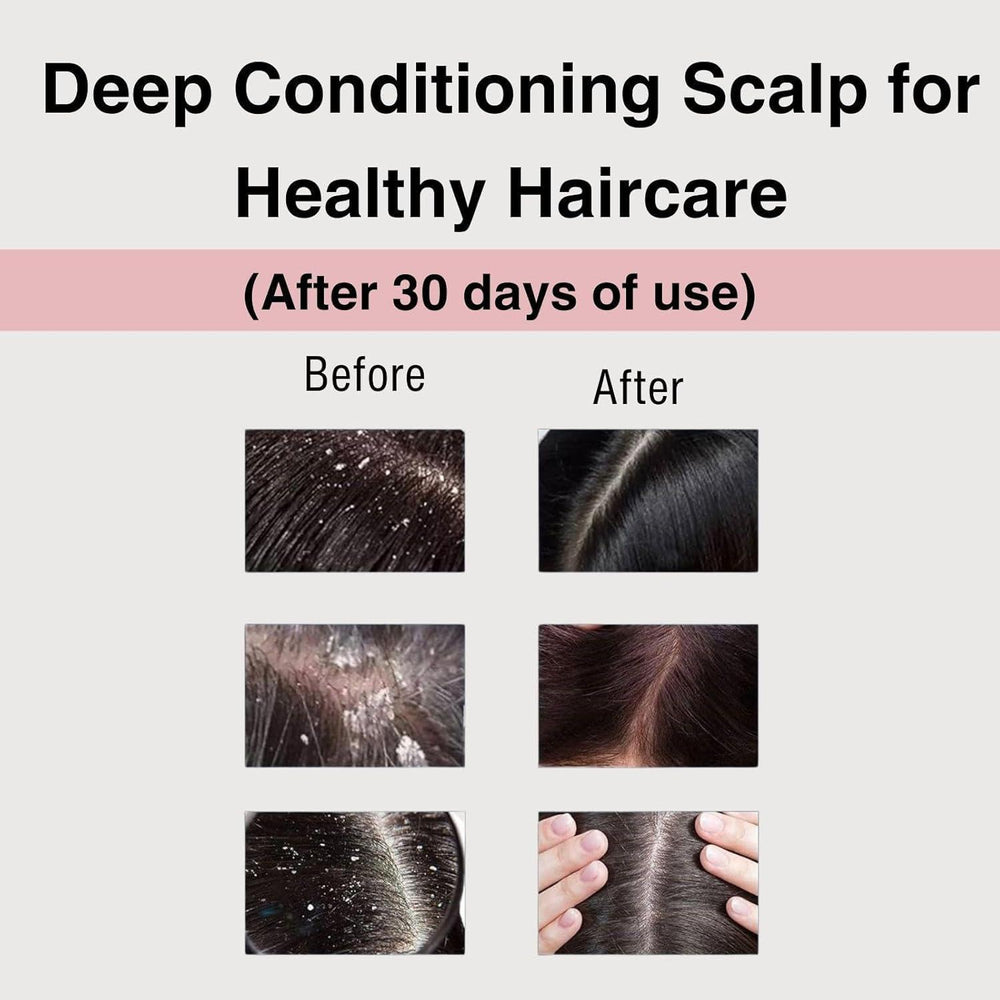 
                      
                        Moist Diane Perfect Beauty Extra Vital 黛丝恩致美系列头皮养护洗发护发 450mL
                      
                    