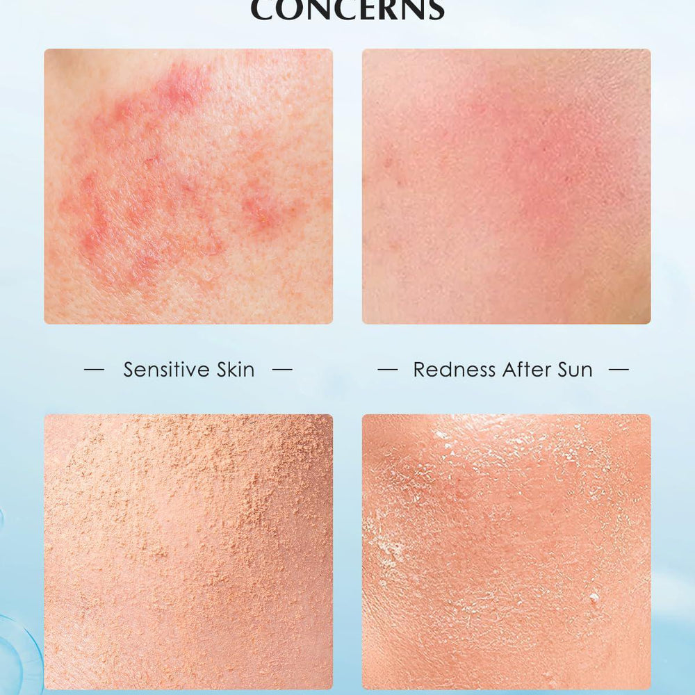 
                      
                        Comfy D-Recombinant Collagen Restoration Single Use Essence 可复美重组胶原蛋白肌御修护次抛精华 30days
                      
                    