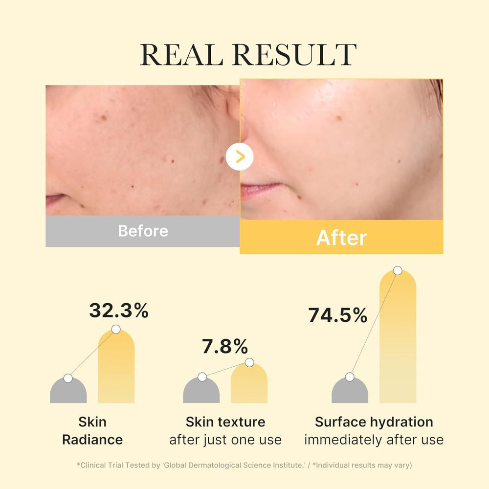 
                      
                        Medicube Kojic Acid Turmeric Brightening Gel Mask 美蒂秋芙曲酸姜黄亮白黄金果冻凝胶面膜 4ea
                      
                    