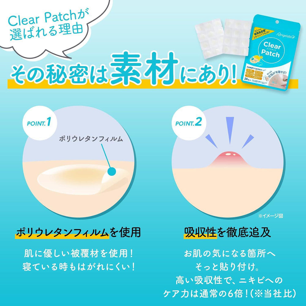 
                      
                        Angelab Clear Patch 日本Angelab透明贴片 24pcs
                      
                    