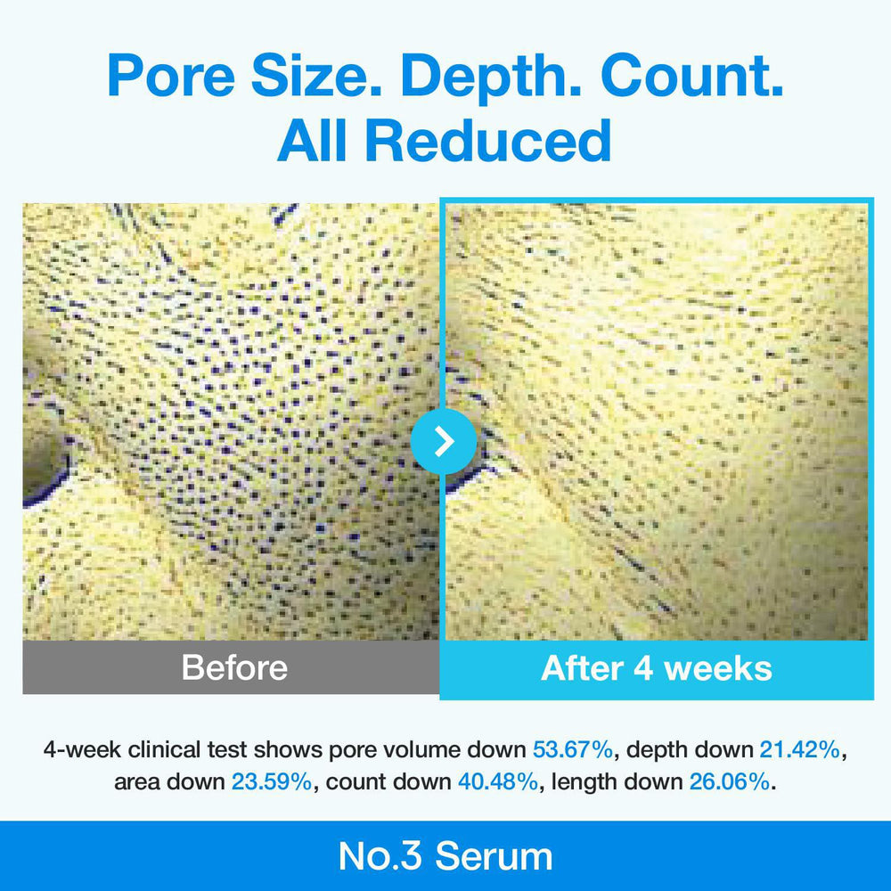 
                      
                        Numbuzin No.3 Retinol Serum Blue Bio-Retinol Pore Refining Serum 韩国Numbuzin3号蓝色生物视黄醇毛孔细致精华液 30mL
                      
                    