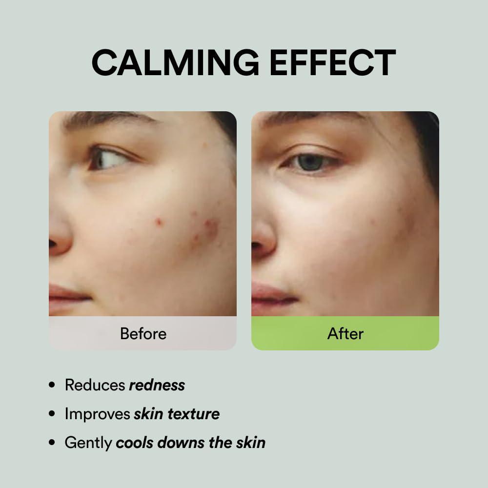 
                      
                        Abib Heartleaf Teca Capsule Serum Calming Drop 阿彼芙心叶TECA胶囊精华液 50mL
                      
                    