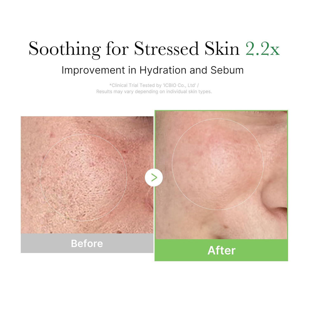 
                      
                        Medicube Exosome Cica Cream 美蒂秋芙积雪草保湿面霜 50mL
                      
                    