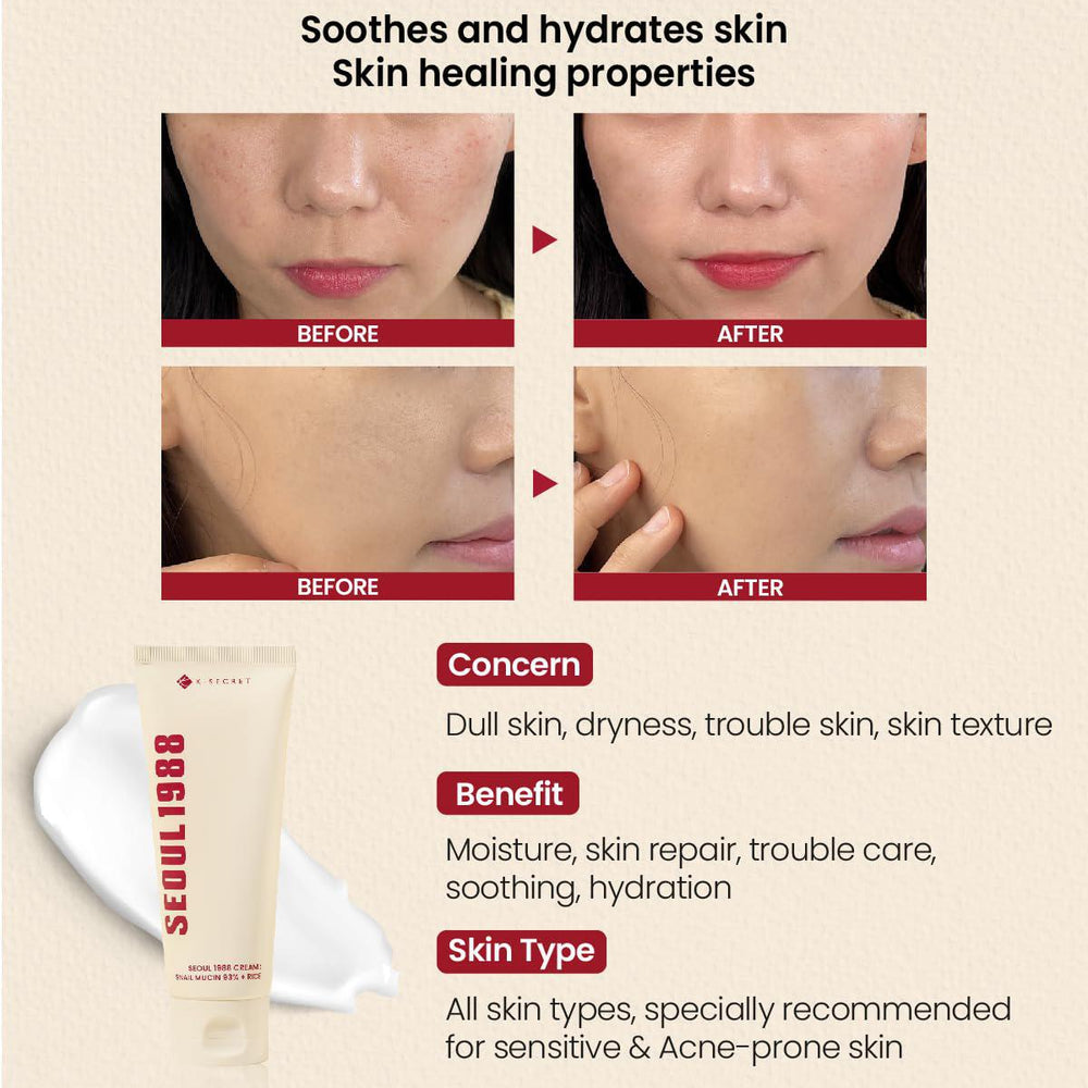 
                      
                        K-SECRET SEOUL 1988 Cream - Snail Mucin 93% + Rice 韩国K-SECRET1988面霜93%蜗牛胶原蛋白+大米 100mL
                      
                    