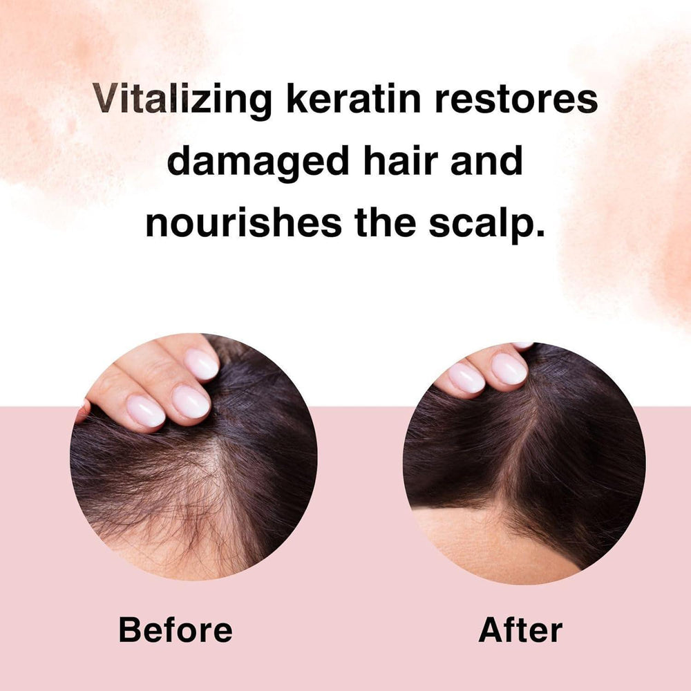 
                      
                        Moist Diane Perfect Beauty Extra Vital 黛丝恩致美系列头皮养护洗发护发 450mL
                      
                    