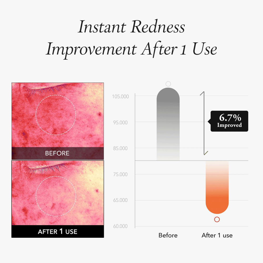 
                      
                        APRIL SKIN Corrotenee Ipmp Instant Calming Serum Pads 胡萝卜素精华爽肤片 80pcs
                      
                    