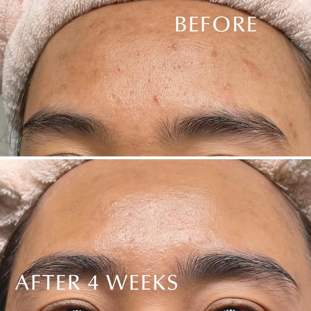 
                      
                        ALBION Skin Conditioner Essential 澳尔滨肌肤护理健康水
                      
                    