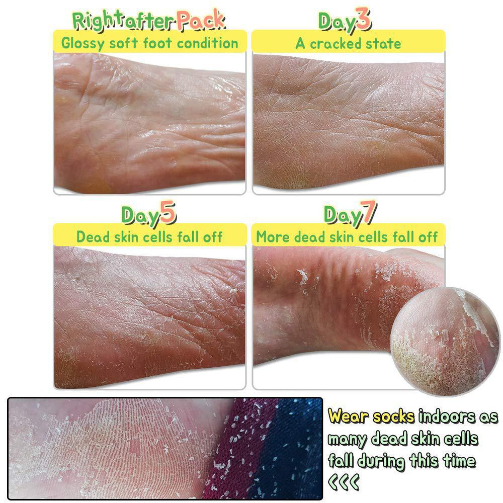 
                      
                        Elizavecca Turtle's Foot Pack 恶魔猪去角质足膜 1pc
                      
                    