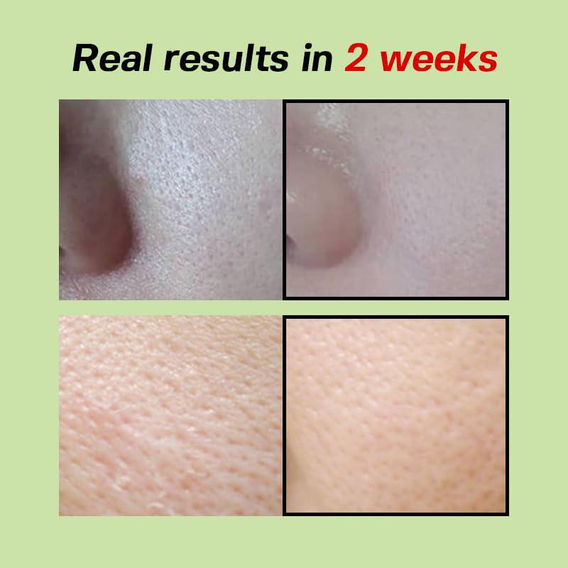
                      
                        Sungboon Editor Green Tomato Pore Lifting Ampoule 韩国Sungboon Editor青番茄毛孔紧致保湿精华液 30mL
                      
                    