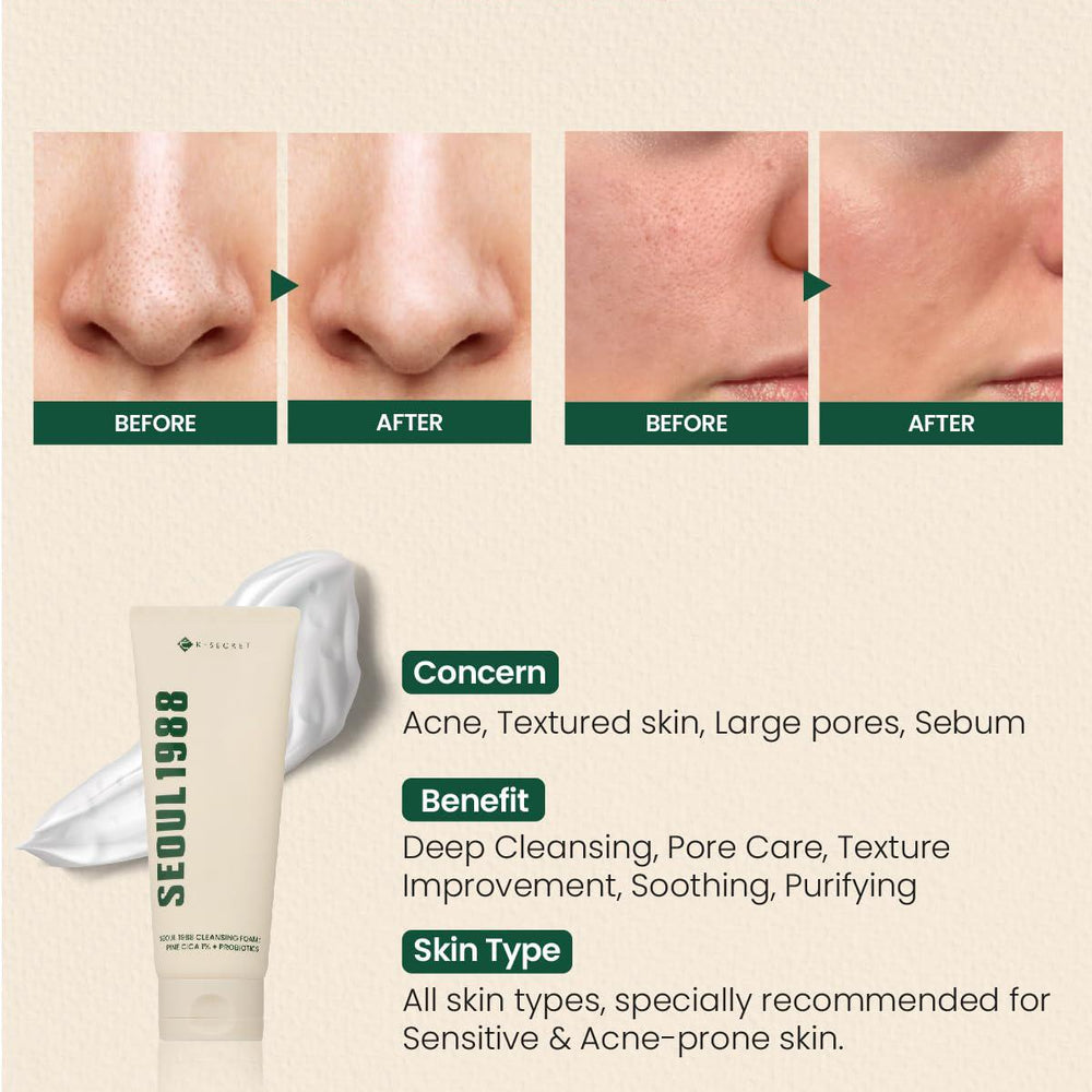 
                      
                        K-SECRET SEOUL 1988 Cleansing Foam - Pine Cica 1% + Probiotics 韩国K-SECRET1988毛孔清洁1%松树积雪草+益生菌 150mL
                      
                    
