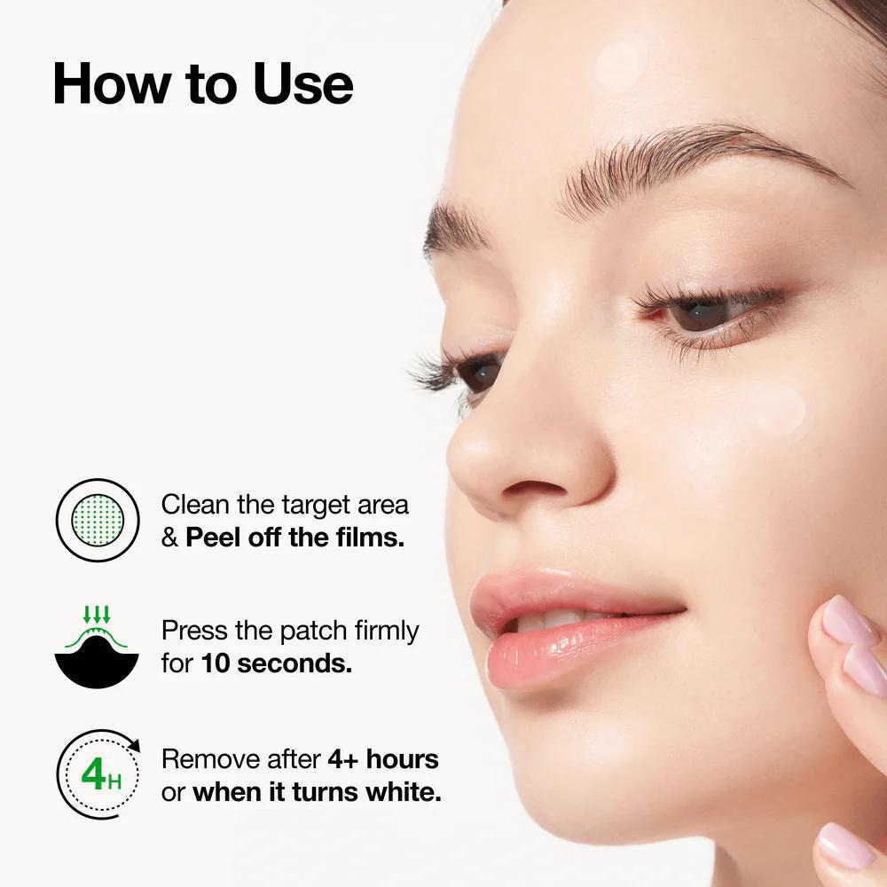 
                      
                        ANUA Triple Acid Spot Care Microdart Patch 韩国ANUA微针祛痘贴 12EA
                      
                    