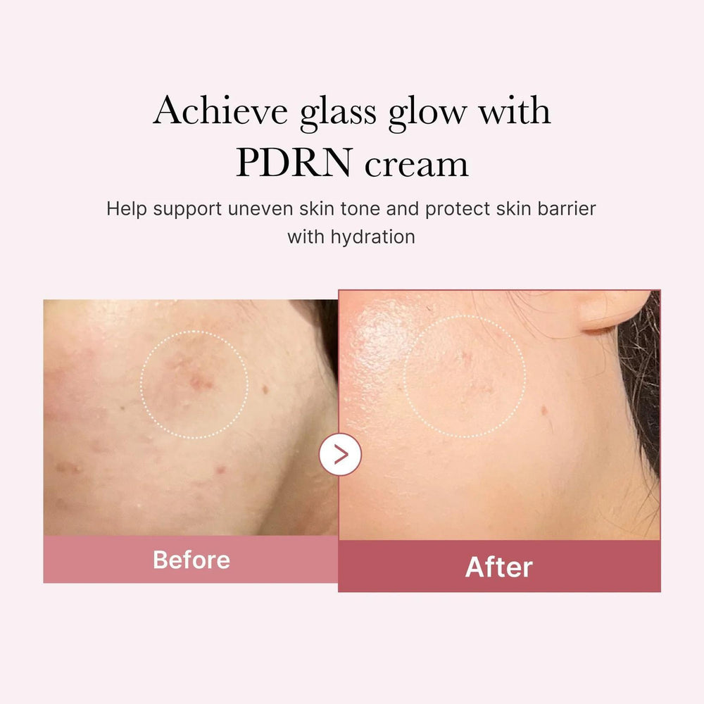 
                      
                        Medicube PDRN Pink Hyaluronic Moisturizing Cream 美蒂秋芙PDRN粉红肽保湿面霜 50mL
                      
                    
