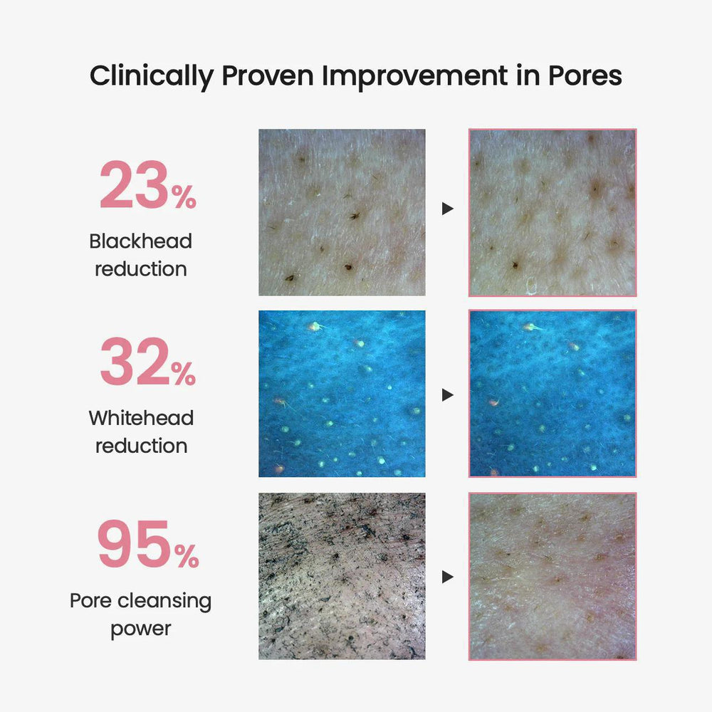 
                      
                        Biodance Collagen Cleansing Oil 贝欧丹斯胶原蛋白深层卸妆油 200mL
                      
                    