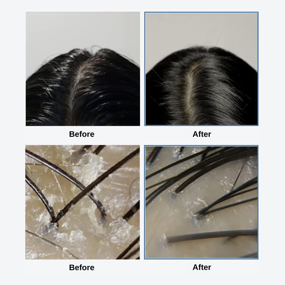 
                      
                        Growus Sea Salt Therapy Scalp Scaler 韩国Growus海盐磨砂洗发膏 250g
                      
                    