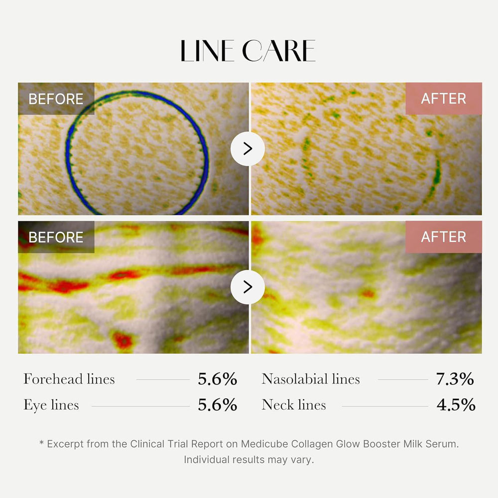 
                      
                        Medicube Collagen Glow Booster Serum 美蒂秋芙胶原蛋白牛奶保湿精华 15mL
                      
                    