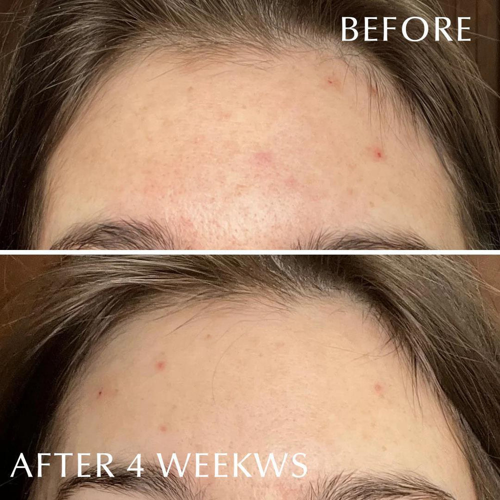 
                      
                        ALBION Skin Conditioner Essential 澳尔滨肌肤护理健康水
                      
                    