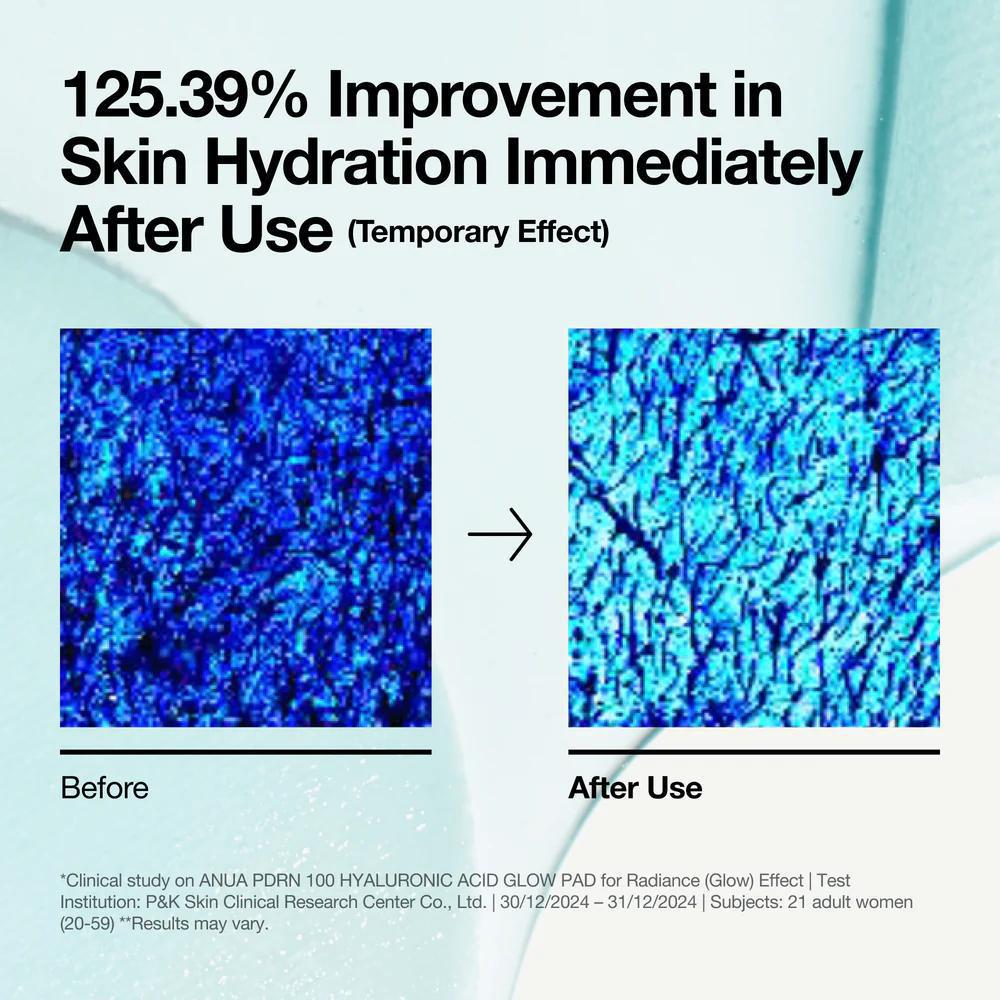 
                      
                        ANUA PDRN 100 Hyaluronic Acid Glow Pad 韩国ANUA100补水保湿爽肤片 180mL
                      
                    