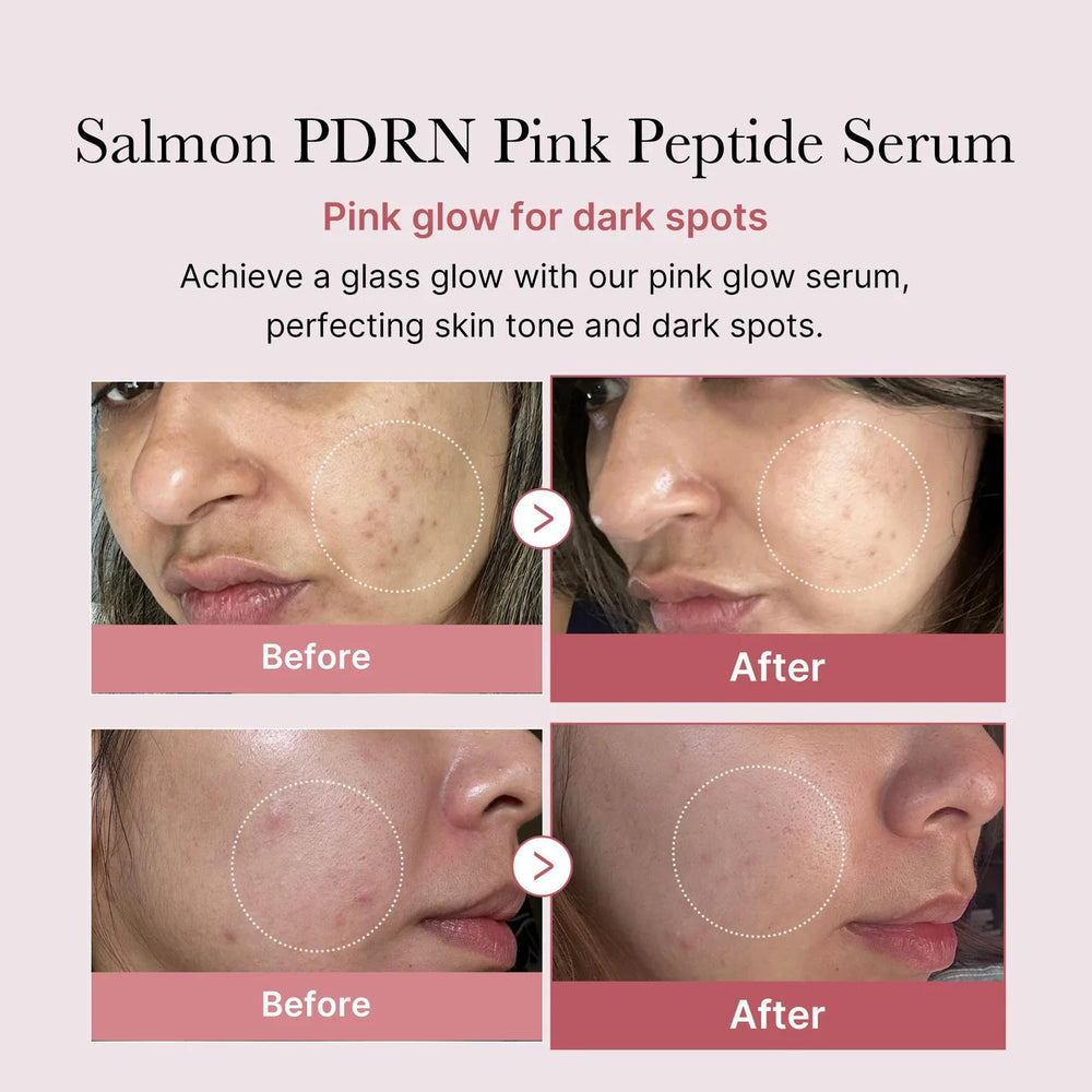 
                      
                        Medicube Salmon DNA PDRN Pink Peptide Serum 美蒂秋芙紧致水润粉色肽精华 30mL
                      
                    
