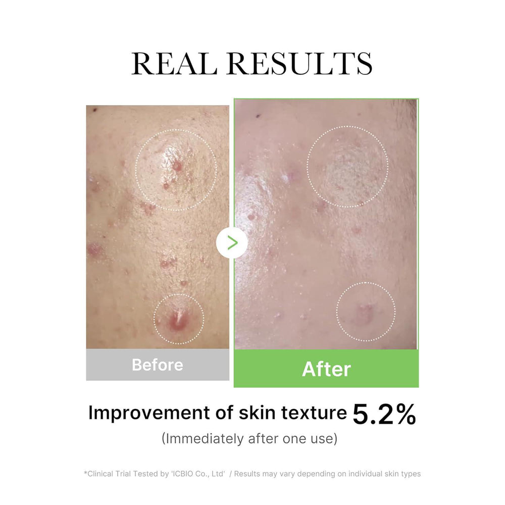 
                      
                        Medicube Super Cica Serum Ampoule 美蒂秋芙茶树保湿精华液 30mL
                      
                    