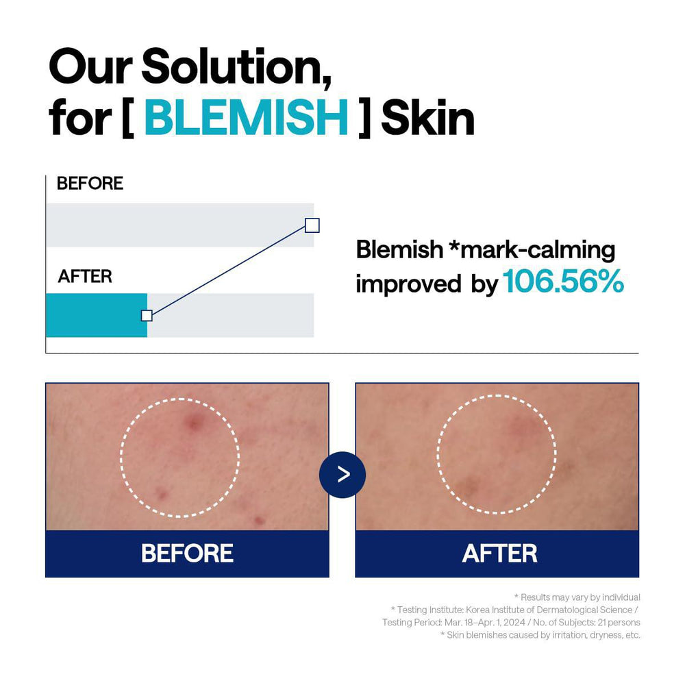 
                      
                        Mediheal Madecassoside Blemish Repair Serum 美迪惠尔积雪草苷淡斑修复精华 40mL
                      
                    
