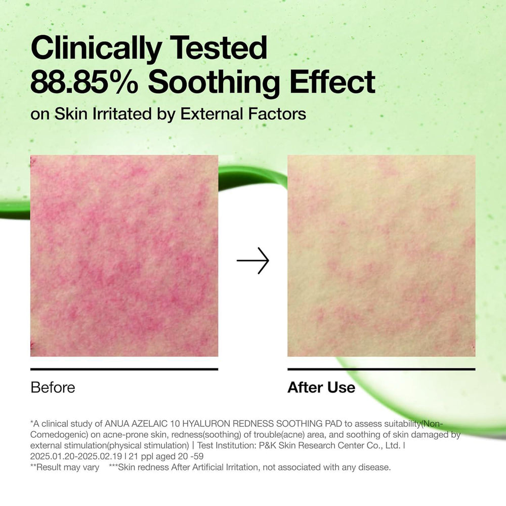 
                      
                        ANUA Azelaic Acid 10 Hyaluron Redness Soothing Pad 韩国ANUA壬二酸10透明质酸保湿棉片 90pads
                      
                    